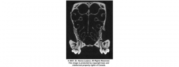Micro-CT image of a mouse skull including the maxilla and the first molars.