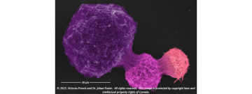 Scanning electron microscopy image of cryptococcus neoformans cells grown in low iron media.